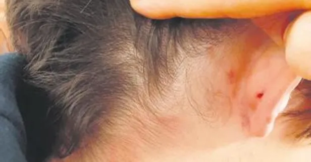 Eskişehir’de öğretmen, 10 yaşındaki öğrencisini tekme tokat dövdü