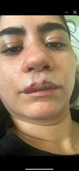 Son dakika: Ünlü estetisyen Op. Dr. Bilgehan Aydın'dan skandal olay! Burun operasyonu için kulağını kesti: Psikolojisi bozuldu-8