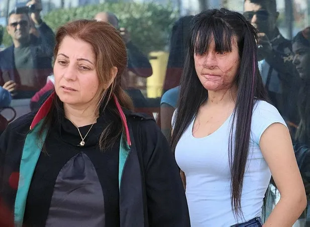 Berfin Özek kendisine asitle saldıran Casim Ozan Çeltik'le neden evlendi? Babası konuştu: Onaylamıyorum-9