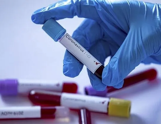 Efes’te 4 pozitif vaka