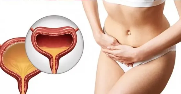 Mesane kanseri hem kadınları hem erkekleri tehdit ediyor! İlk suçlu sigara...