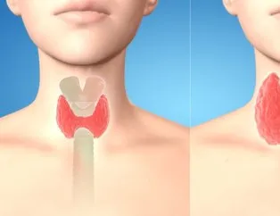 Tiroidle işimiz yaş