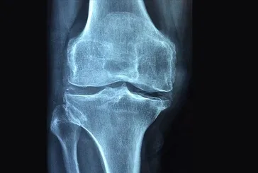 Kemikler için güçlü bir adım