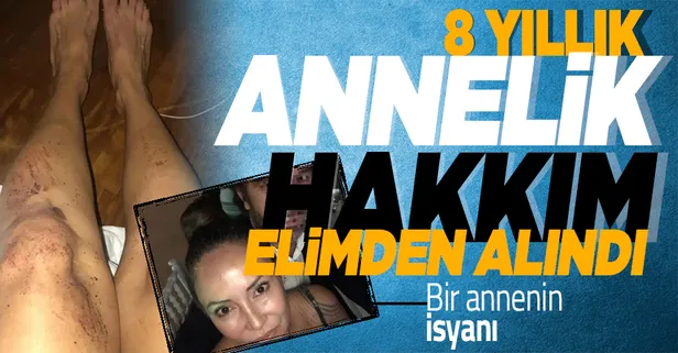Feci şekilde darp edilen kadının yardım çığlığı: Annelik hakkım elimden alındı