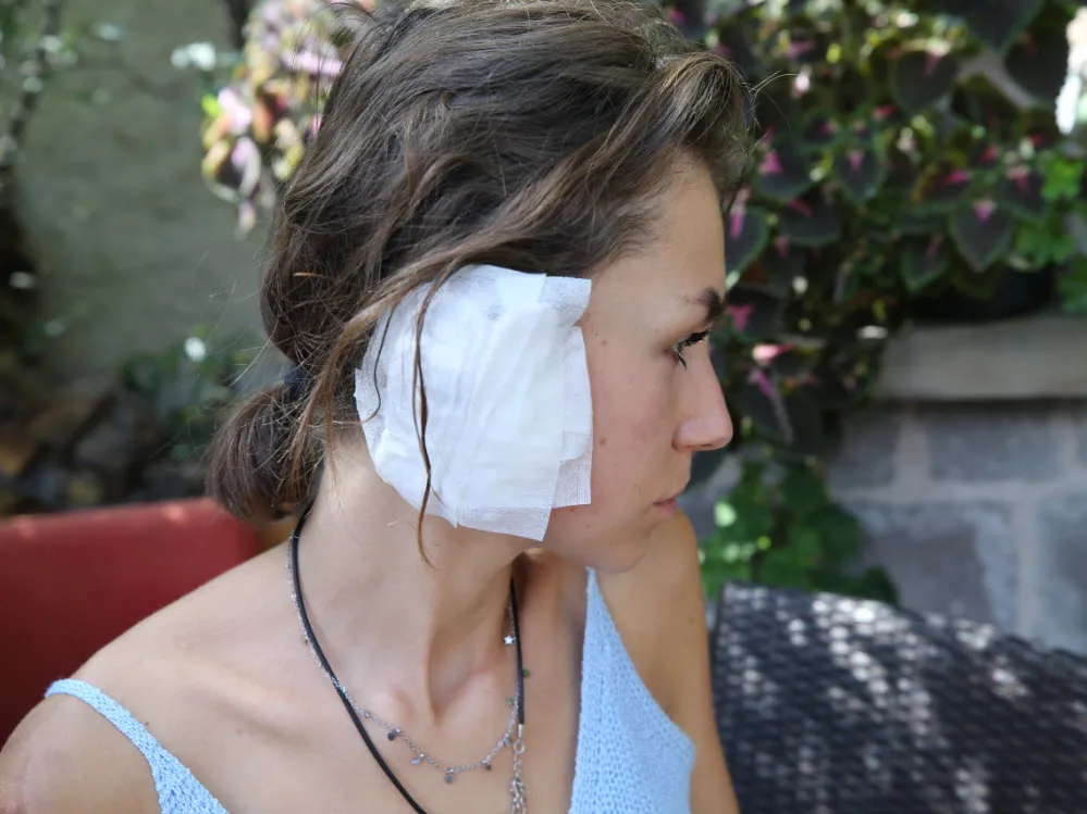 Başıboş köpek sorunu turizmi tehdit ediyor! Kapadokya'da 2 İtalyan turist yaralandı: Korku dolu anlar - 3