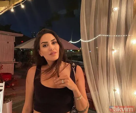 Survivor Sahra Işık öyle bir değişti ki tanımak bile güç artık! Sahra estetikle başka biri oldu son hali inanılmaz - 8