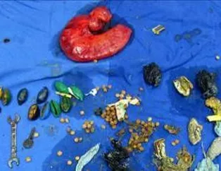 Hepsi 'mide'sinden çıktı