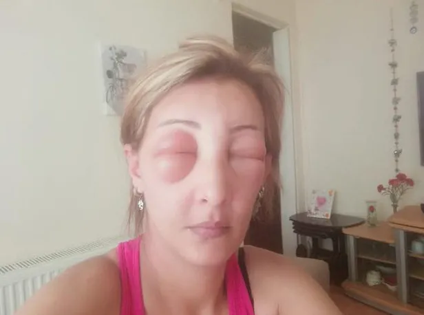 Yalova'da saçlarına boya yaptırmak isteyen kadın canından oluyordu-3