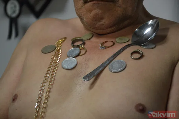 ‘Mıknatıs adam’ Süleyman! Çatal kaşık metal vücuduna yapışıyor! İlçenin en çekici adamı - 2