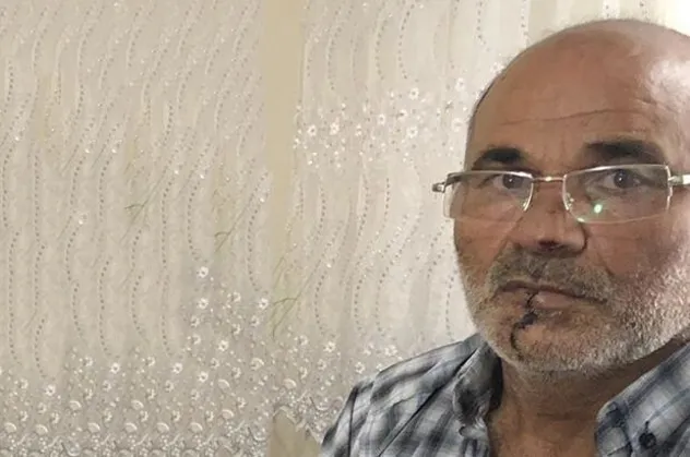 İstanbul Pendik’te öfkeli damat, kayınpederinin dudağını ısırdı!