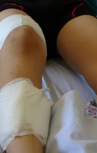 Bingöl'de 7 yaşındaki çocuk köpeklerin saldırısına uğradı