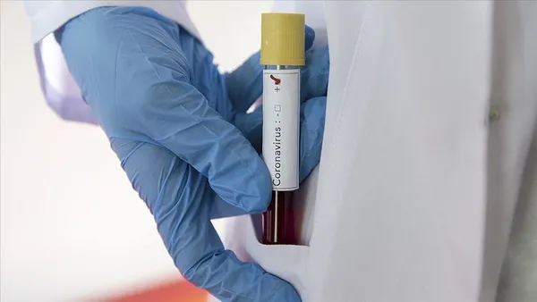 Anne adaylarına koronavirüs uyarısı! Kovid-19 erken doğum riskini artırıyor-1