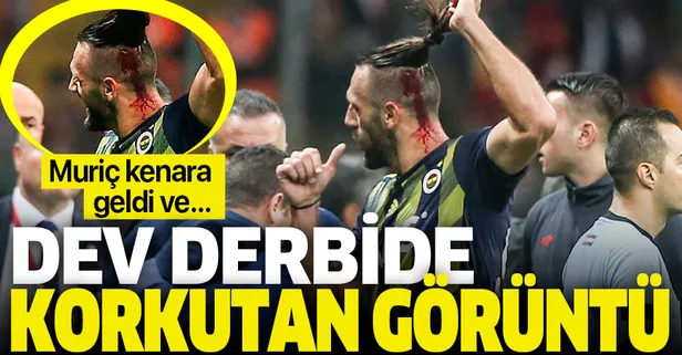 Dev derbide Vedat Muriç başından yaralandı