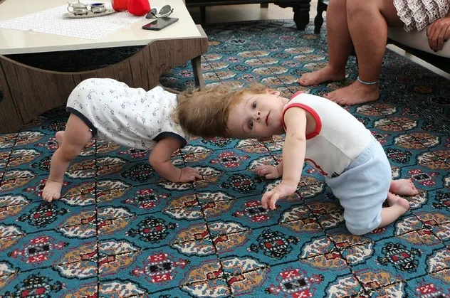 Başkan Erdoğan güzel haberi duyurmuştu! Antalyalı siyam ikizleri Derman ve Yiğit Evrensel'den yeni fotoğraf