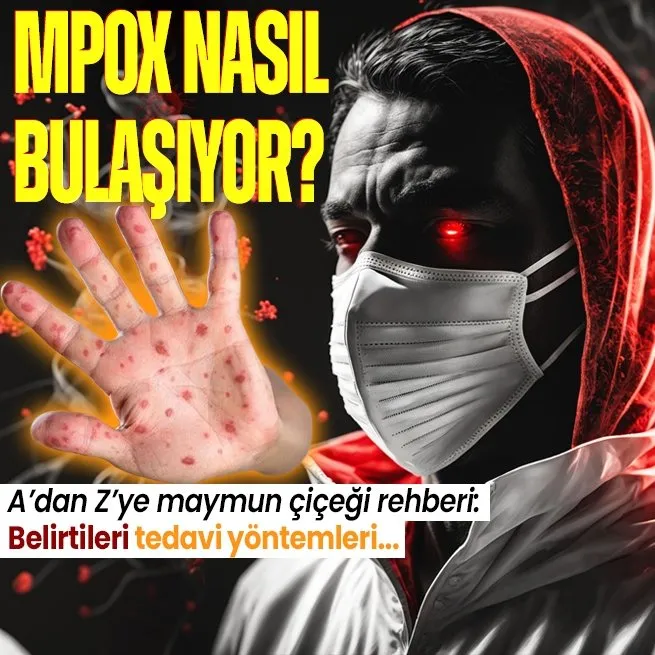 Sağlık Bakanlığı Maymun Çiçeği MPOX rehberi yayımladı! İşte virüsün bulaşma yolları, belirtileri ve tedavisi...
