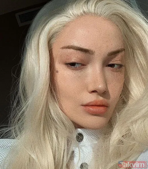 Danla Bilic sonunda bunu da yaptı, estetiğine estetik ekledi! Yüzünde yok yok - 10