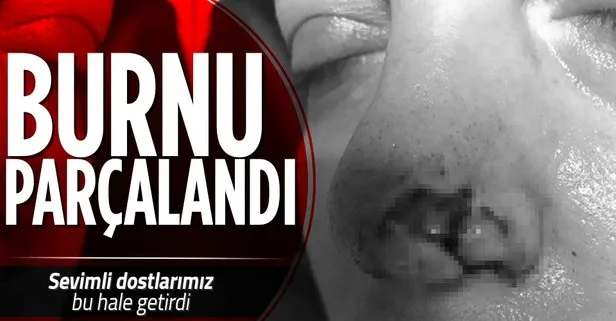 Pitbull bu hale getirdi