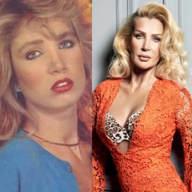 Yüz lifting yaptıran Ebru Yaşar’ın son hali olay oldu: İnsan bunu kendine nasıl yapar? - 10