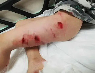 Bir pitbull saldırısı daha! Bu kez adres İzmir!