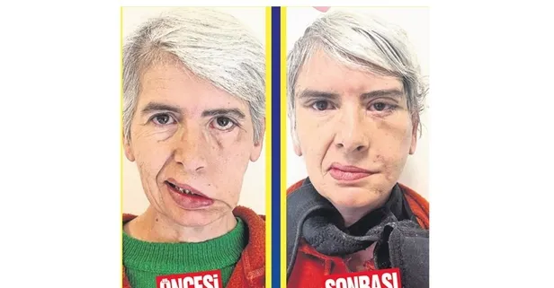 Altın nakliyle mucize yaşadı: 30 yıl sonra ilk kez iki gözü kapalı uyuyabildi!