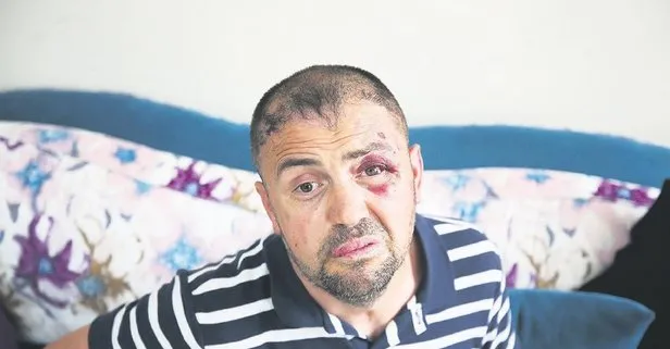 Bursa’da Gazi Ömer Karaman saldırıya uğradı, sosyal medyadan tepki yağdı