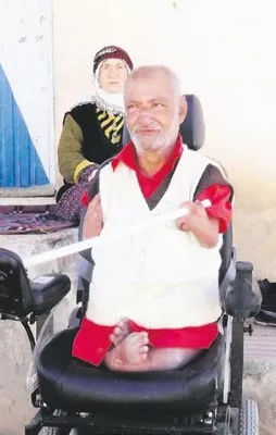 Kolsuz bacaksız hayat mücadelesi