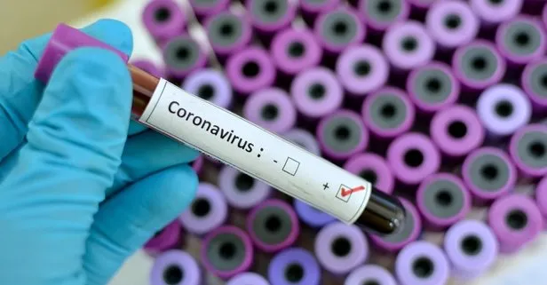 İstanbul, Ankara İzmir corona virüs hangi ilde kaç kişide var? İşte Türkiye il il koronavirüs vaka ölü sayısı