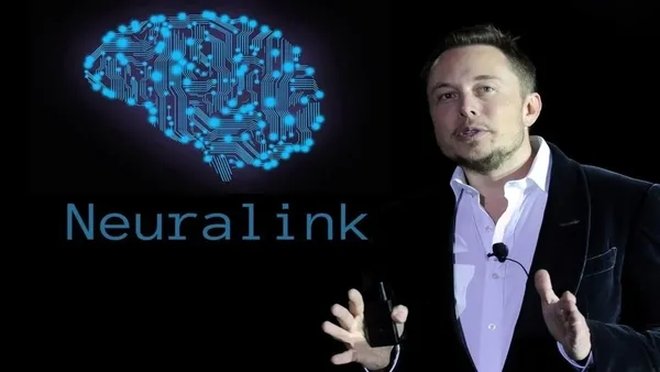 Elon Musk insanlara çip takacak: Neuralink çip tartışma konusu-4