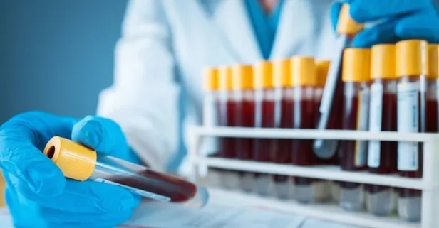 Tahlil sonucu öğrenme işlemi online nasıl yapılır? MHRS, e-Nabız, e-Devlet, T.C. kimlik no ile tahlil, patoloji sonucu…