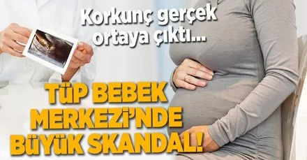 Tup Bebek Merkezi Nde Buyuk Skandal Takvim