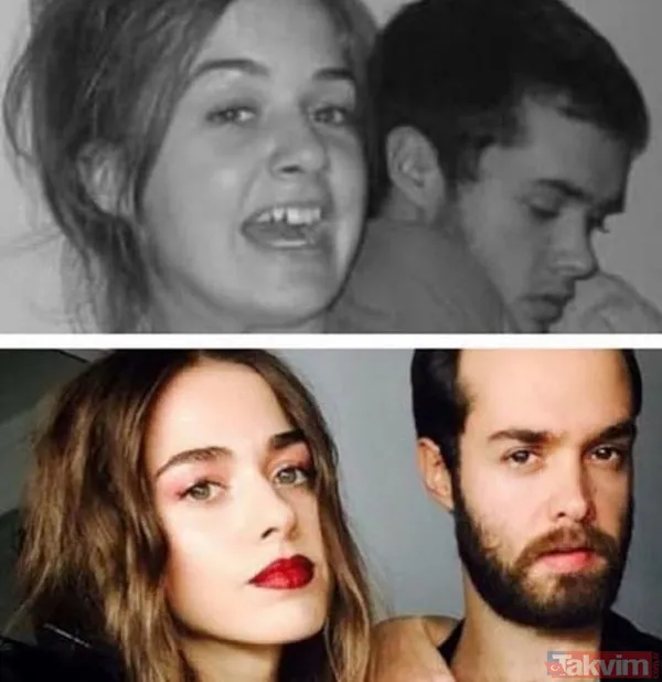 Bensu Soral "Hiç estetiğim yok kendimi güzel bulmuyorum" dedi ortalık birbirine girdi "Tabi biz de yedik" Yüzündeki değişim çok konuşulmuştu - 9