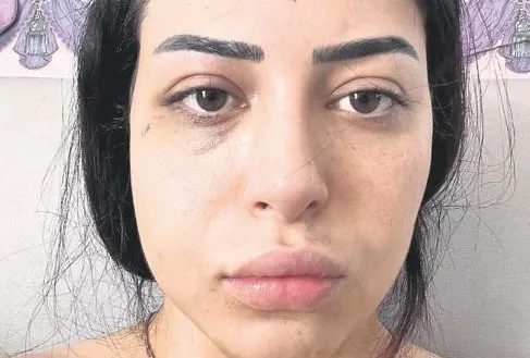 Asya’ya küstah saldırı