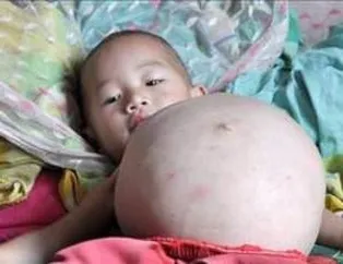 İnanılmaz Tıbbi Vakalar