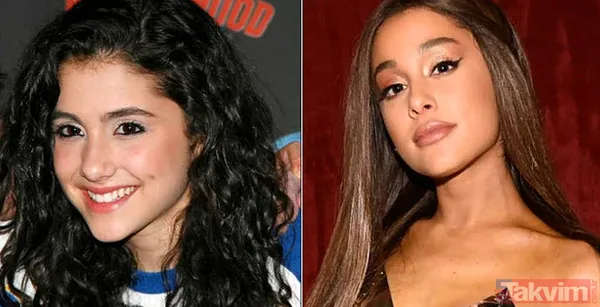 Bella Hadid ve Şeyma Subaşı'nın idolü Hailey Baldwin'in estetik açıklaması olay: Yüzüme asla dokunmadım! - 25