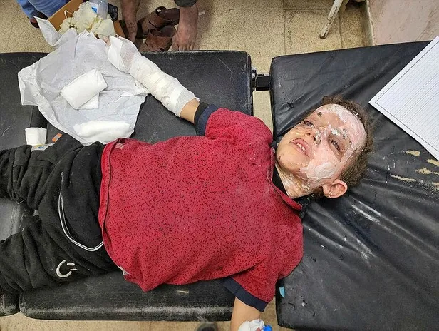 gazzede-icler-acisi-durum-tedavi-olmadigi-icin-siviller-olume-terk-edildi-defnedilemeyenlerin-bir-kismini-ise-1699822060627.jpeg Gazze'de içler acısı durum | Tedavi olmadığı için siviller ölüme terk edildi! Defnedilemeyenlerin bir kısmını ise köpekler parçaladı-5