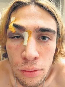 akil-almaz-olay-kaykay-sampiyonu-alparslan-ayhan-bir-grup-tarafindan-saldiriya-ugradi-1660518012018.jpeg Akıl almaz olay! Kaykay şampiyonu Alparslan Ayhan bir grup tarafından saldırıya uğradı-2