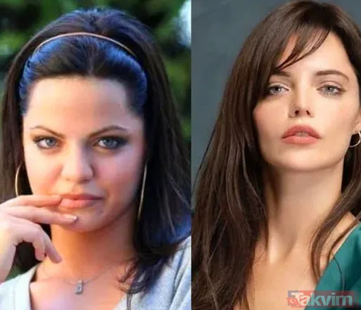 Danla Bilic sonunda bunu da yaptı, estetiğine estetik ekledi! Yüzünde yok yok - 26