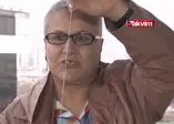 Böbreğinde unutulan telle 5 yıl yaşadı