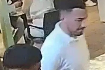 Pastanede tuvalet tartışması kanlı bitti: Genç çalışanın burnu ısırıldı