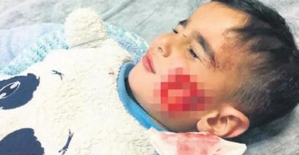 Sanliurfa Viransehir De Basibos Kopekler Cocuklara Saldirdi Takvim