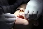 Bu hatalar endişe verir: Diş fırçalamak yetmiyor