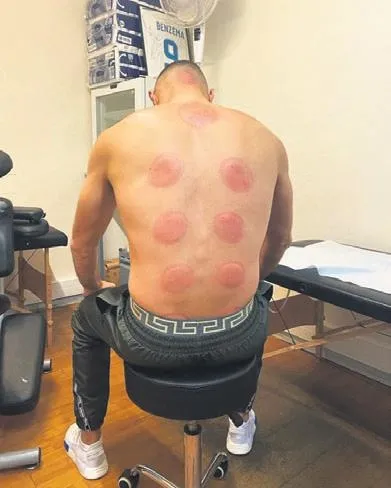 DJ Baran Taşkut ve arkadaşları, ücreti beğenmedi çalışanları darp etti (Yaşam haberleri)-3