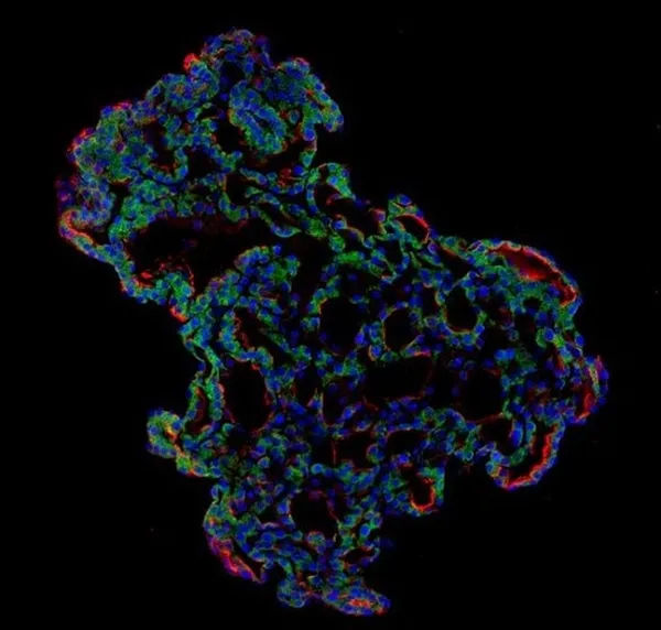 Son dakika: Koronavirüs akciğerlere işte böyle yayılıyor-3