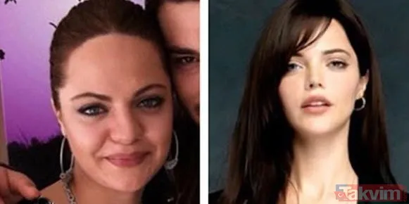 Danla Bilic sonunda bunu da yaptı, estetiğine estetik ekledi! Yüzünde yok yok - 30