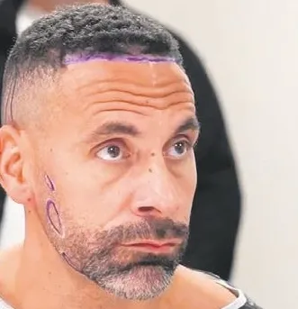 Efsanevi futbolcu Rio Ferdinand, İstanbul'a gelip saç-sakal ektirdi! Türk sağlık sistemini öve öve bitiremedi-3
