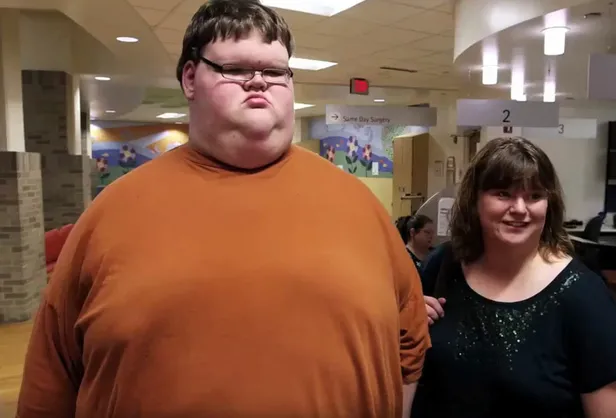 15 yaşındayken 320 kiloydu! Ameliyat olduktan sonra bambaşka biri oldu-4