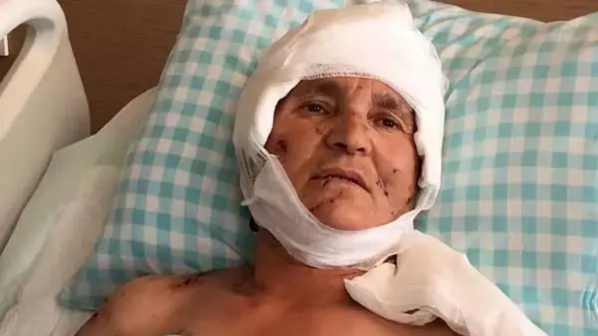 Yargıtay'dan emsal karar: Köpek saldırısında yaralanan kadına 637 bin lira tazminat kararı
