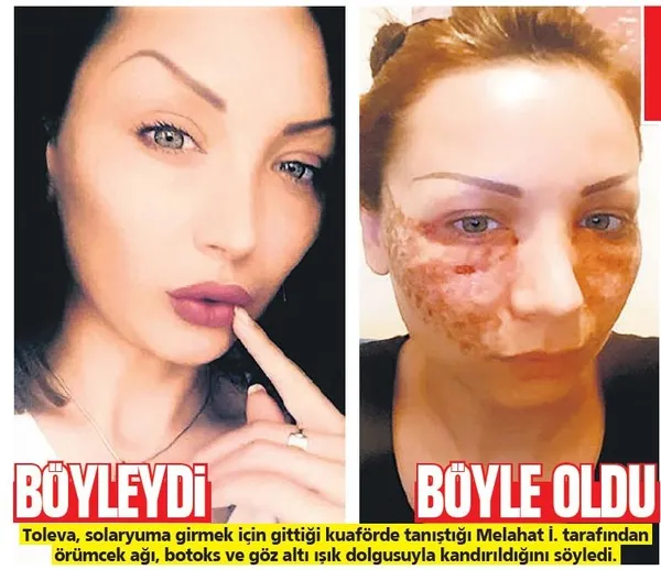 pestetik-1615584472086.jpeg 'Örümcek ağı' hayatını kabusa çevirdi: Tatyana Toleva 2 kuaför hakkında dava açıldı-1