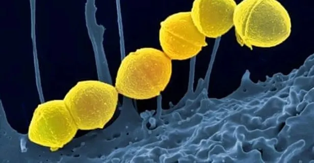 Strep A virüsü nedir, Türkiye'de görüldü mü? Bakterinin aşısı veya tedavisi var mı? Strep A enfeksiyonu belirtileri neler, insandan insana bulaşır mı?