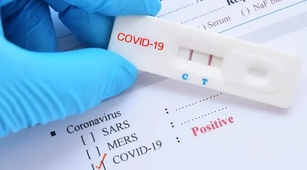 covid test sonucu ne zaman cikar koronavirus covid 19 test sonucu nereden nasil ogrenilir pcr test sonucu sorgulama takvim covid test sonucu ne zaman cikar koronavirus covid 19 test sonucu nereden nasil ogrenilir pcr test sonucu sorgulama takvim